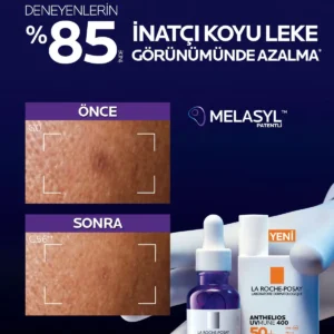 کرم ضد آفتاب آنتلئوس Uvmune 400 با SPF 50 و حجم 50 میلی لیتر، مایع ضد لک پوست صورت - 7146