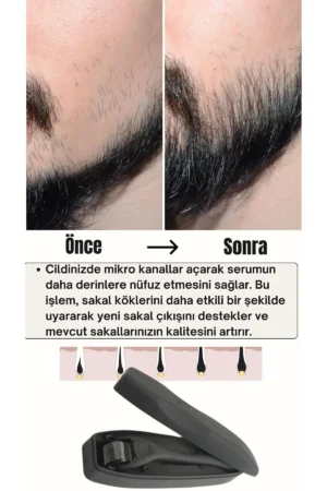 ست سرم کمک کننده به رشد مو و ریش، سرم مغذی و پر کننده - 7680