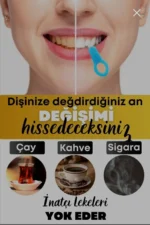 کیس سفیدکننده دندان، پاک کننده لکه‌های چای و قهوه، پاک‌کننده دندان - 8537